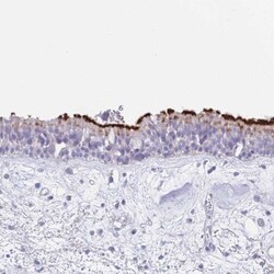 CPXM2 Antibody, Novus Biologicals:Antibodies:Primary Antibodies